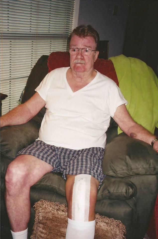 An elderly man dressed in casual wear rests on a couch with a bandaged leg.