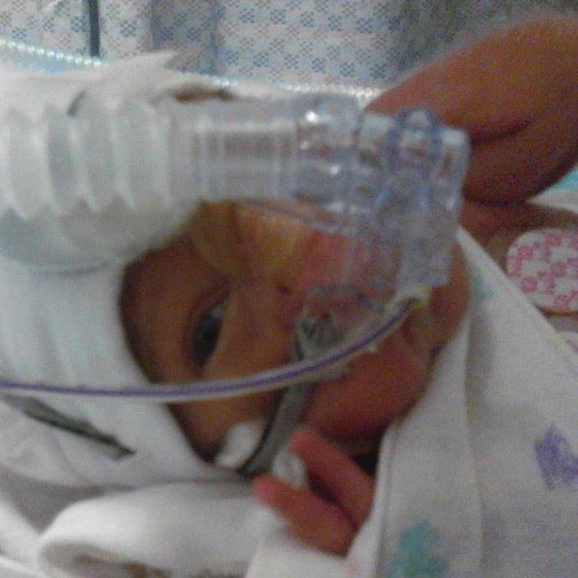 Newborn is being treated with a respiratory device in a care unit during nighttime.