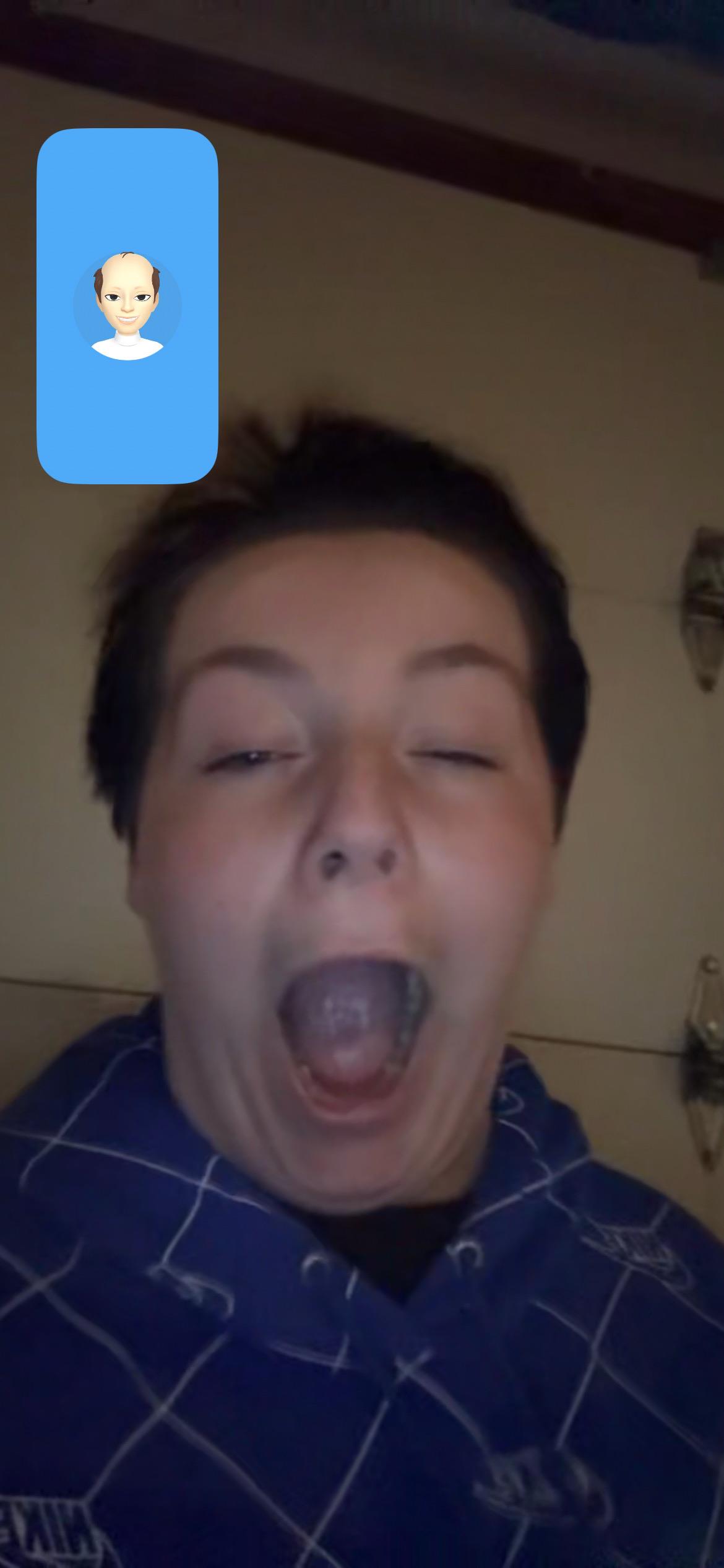 A boy with his mouth open