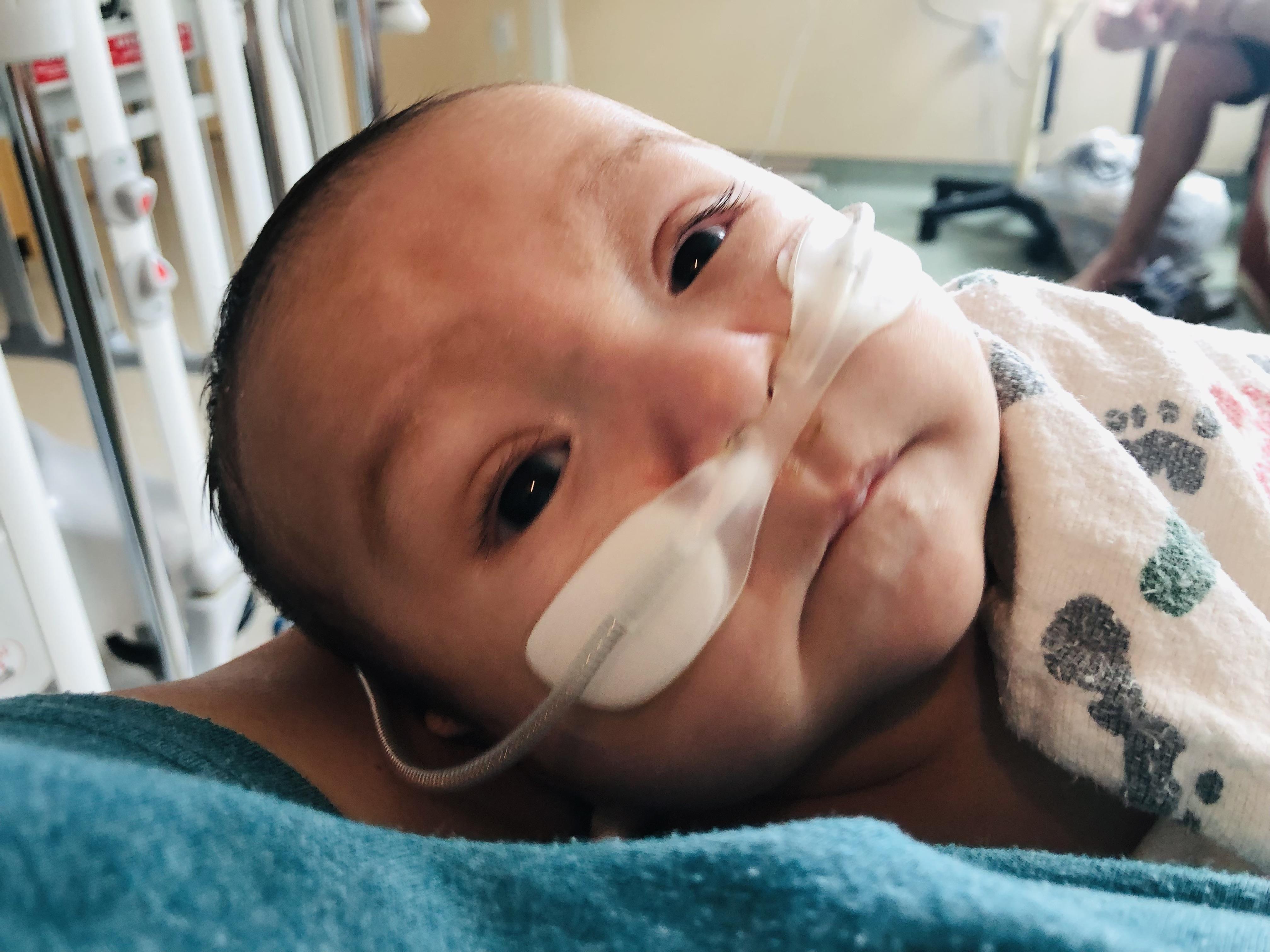 A newborn with medical equipment is being held in a supportive hospital environment.