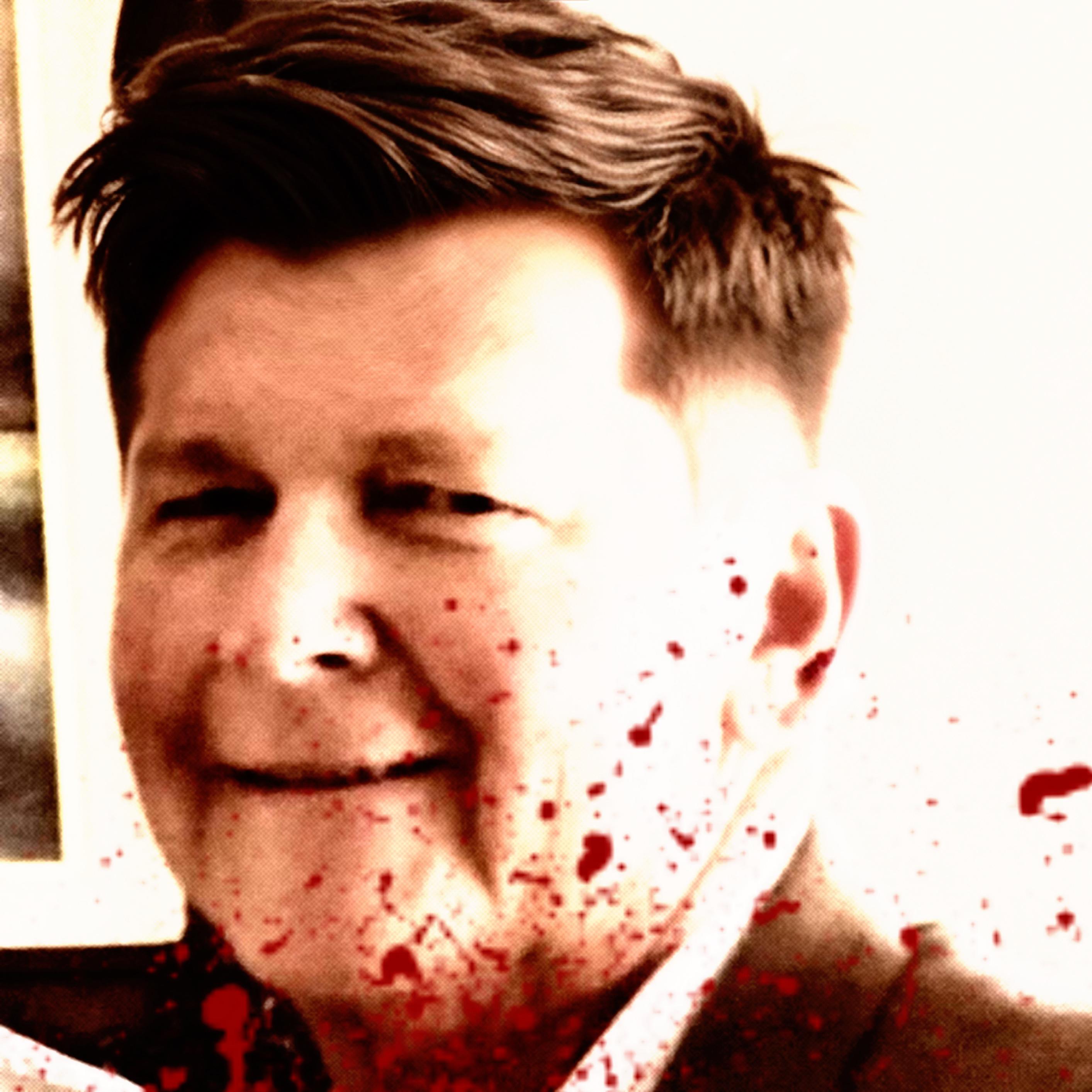 A man with blood splattered on his face