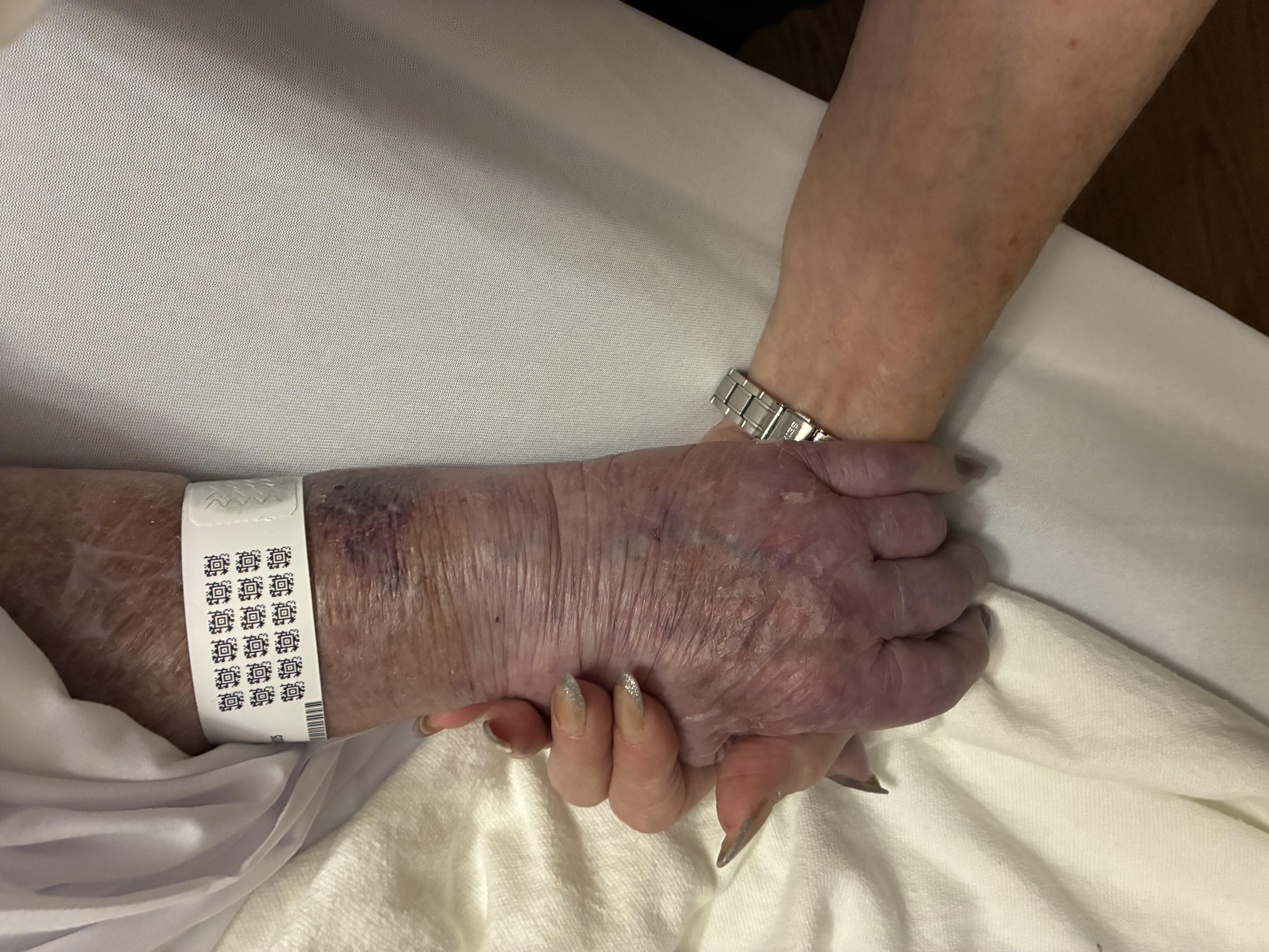 Hands of an older adult and a caregiver gently clasped together in a moment of comfort and support.