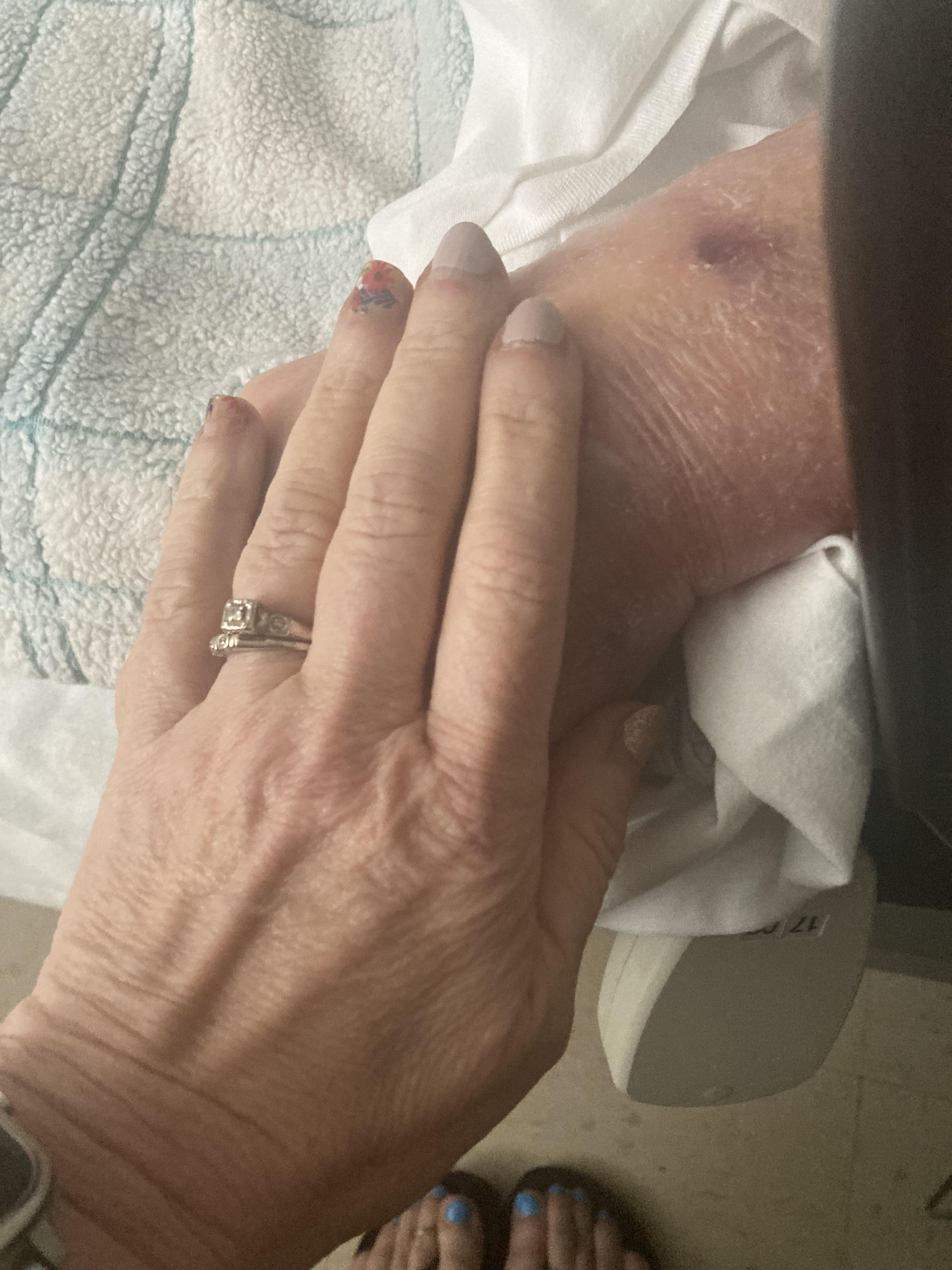 A hand gently rests on a patient's arm, conveying compassion in a healthcare environment.