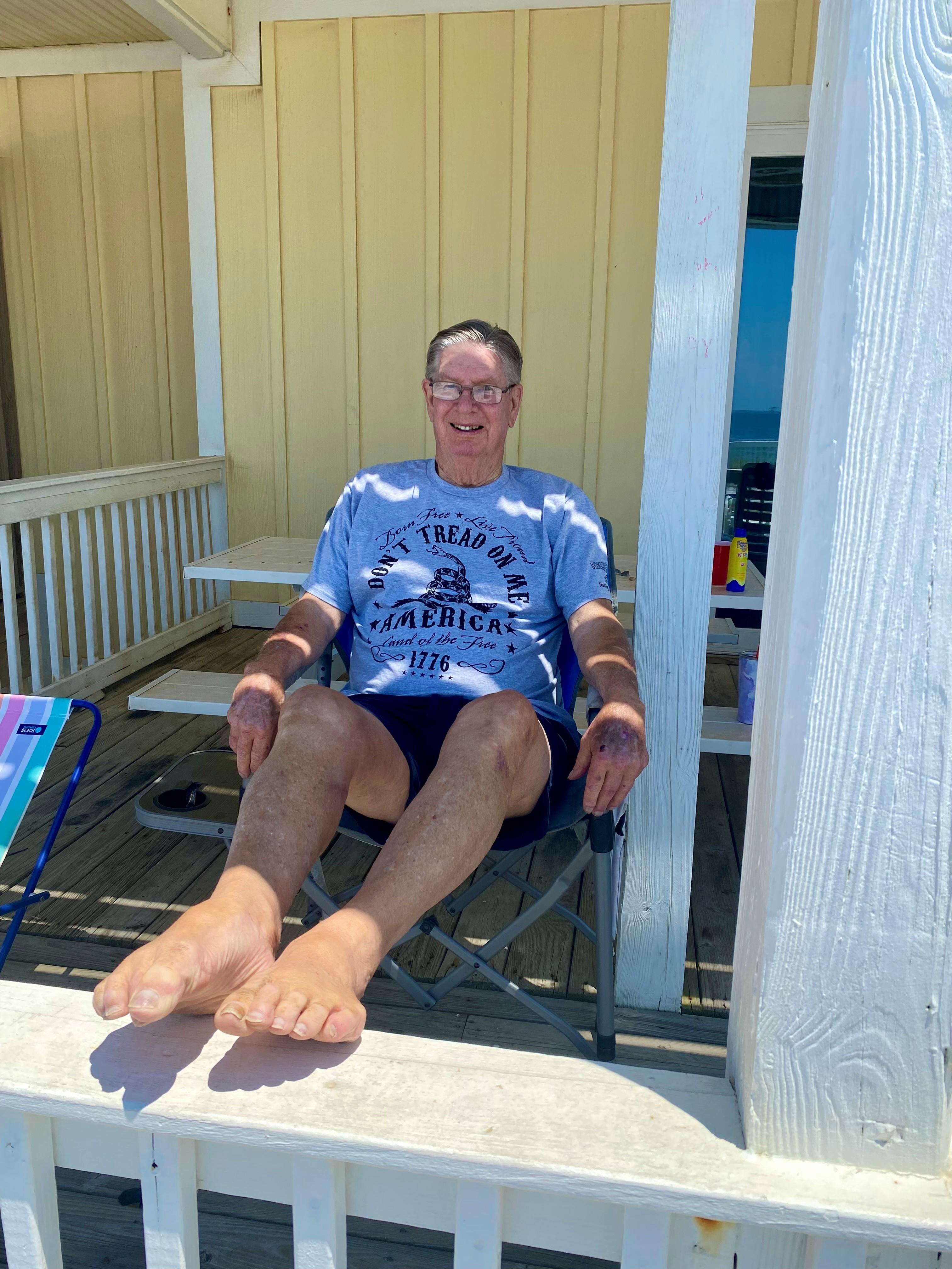 A person enjoys a sunny day sitting comfortably in a beach chair on a porch, soaking up the sun.