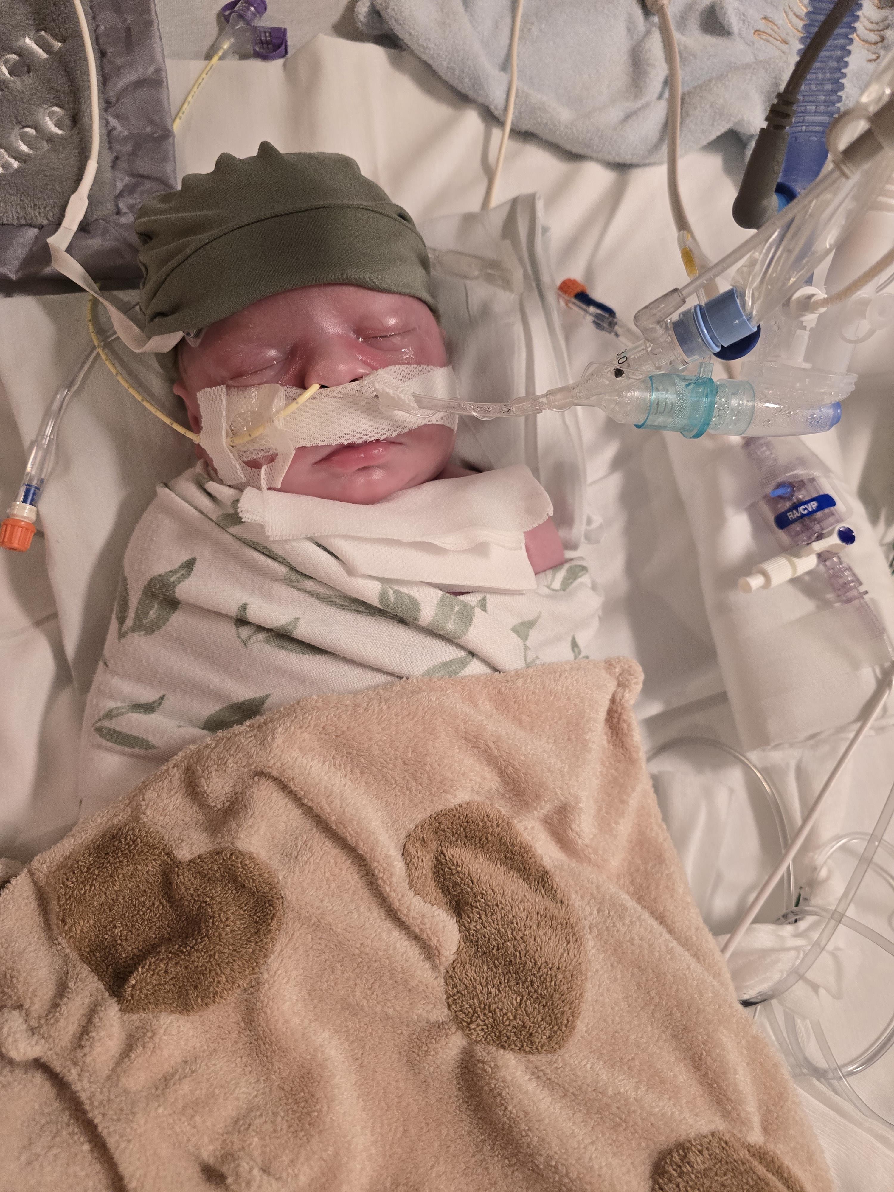 A newborn baby is wrapped in a blanket, receiving vital medical support in a hospital setting.