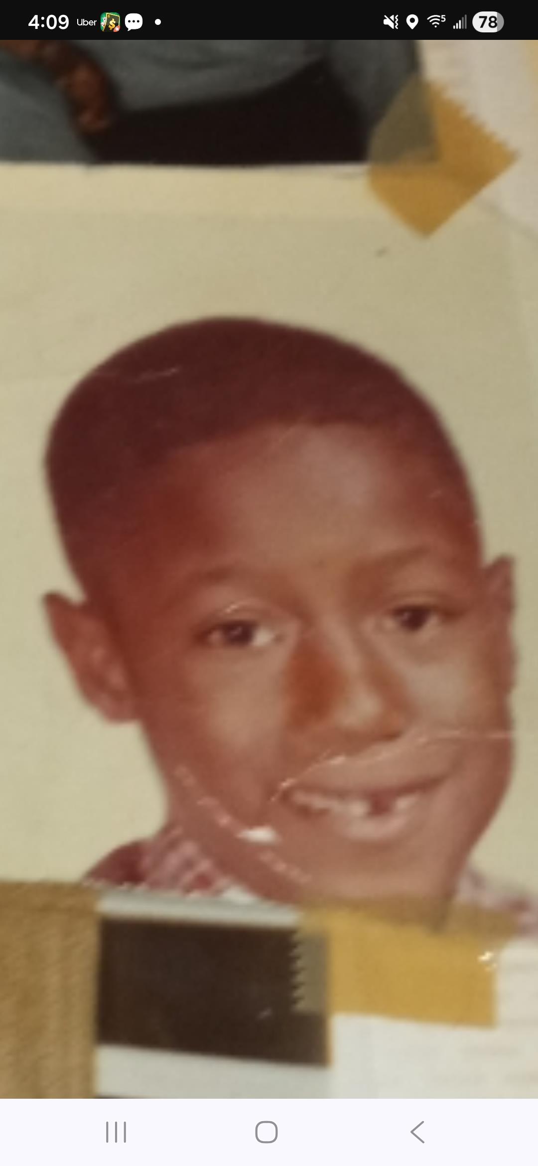 A boy shows a big smile while revealing gaps in his teeth, representing childhood joy and innocence.