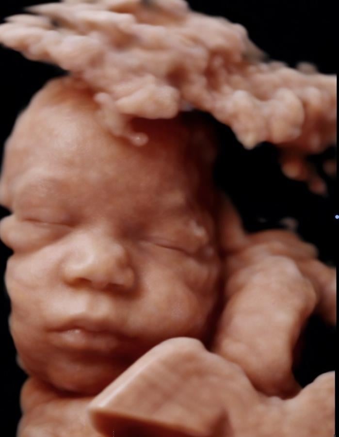 A baby with a cloud of smoke