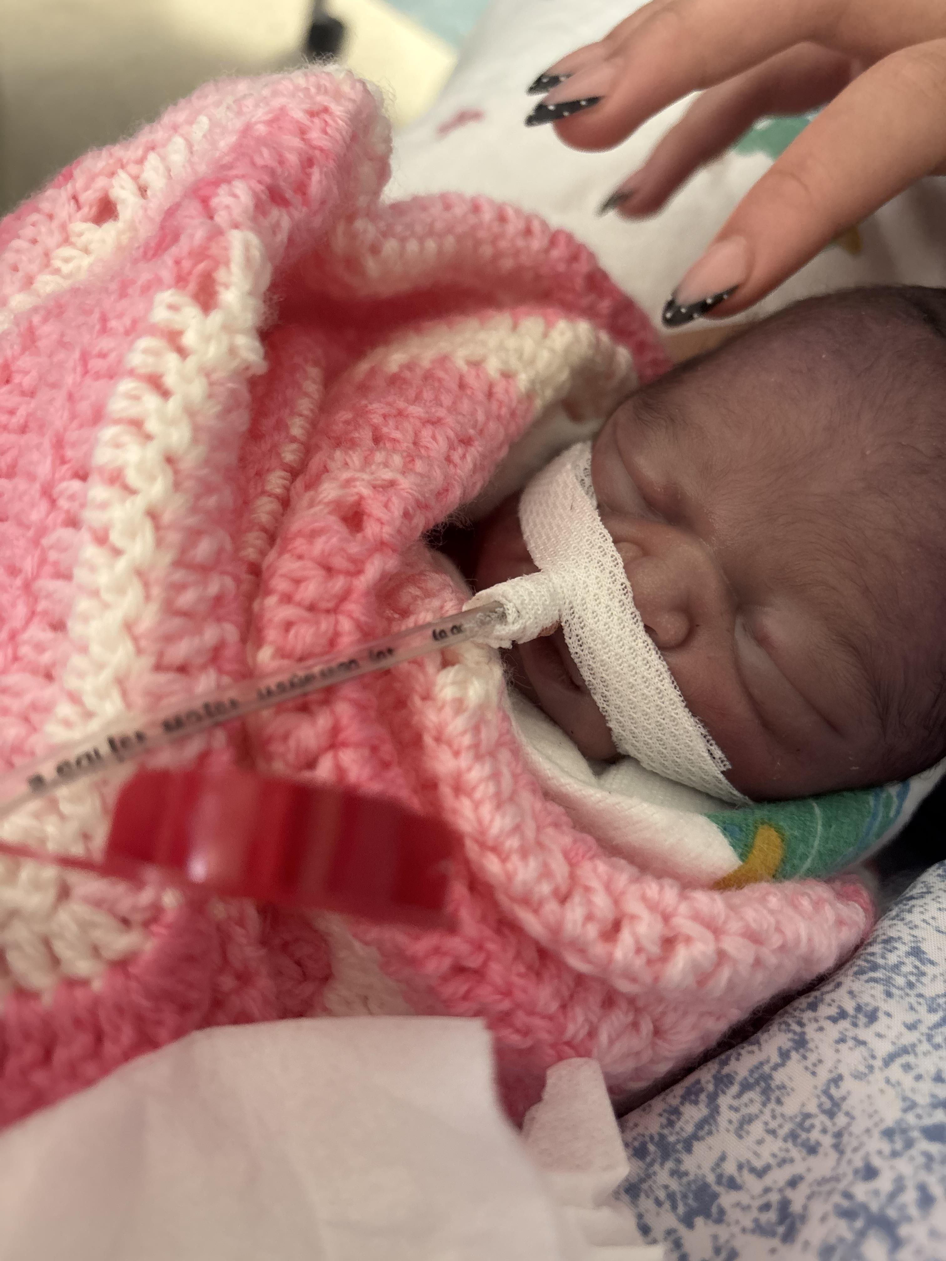 A baby with a needle in its mouth