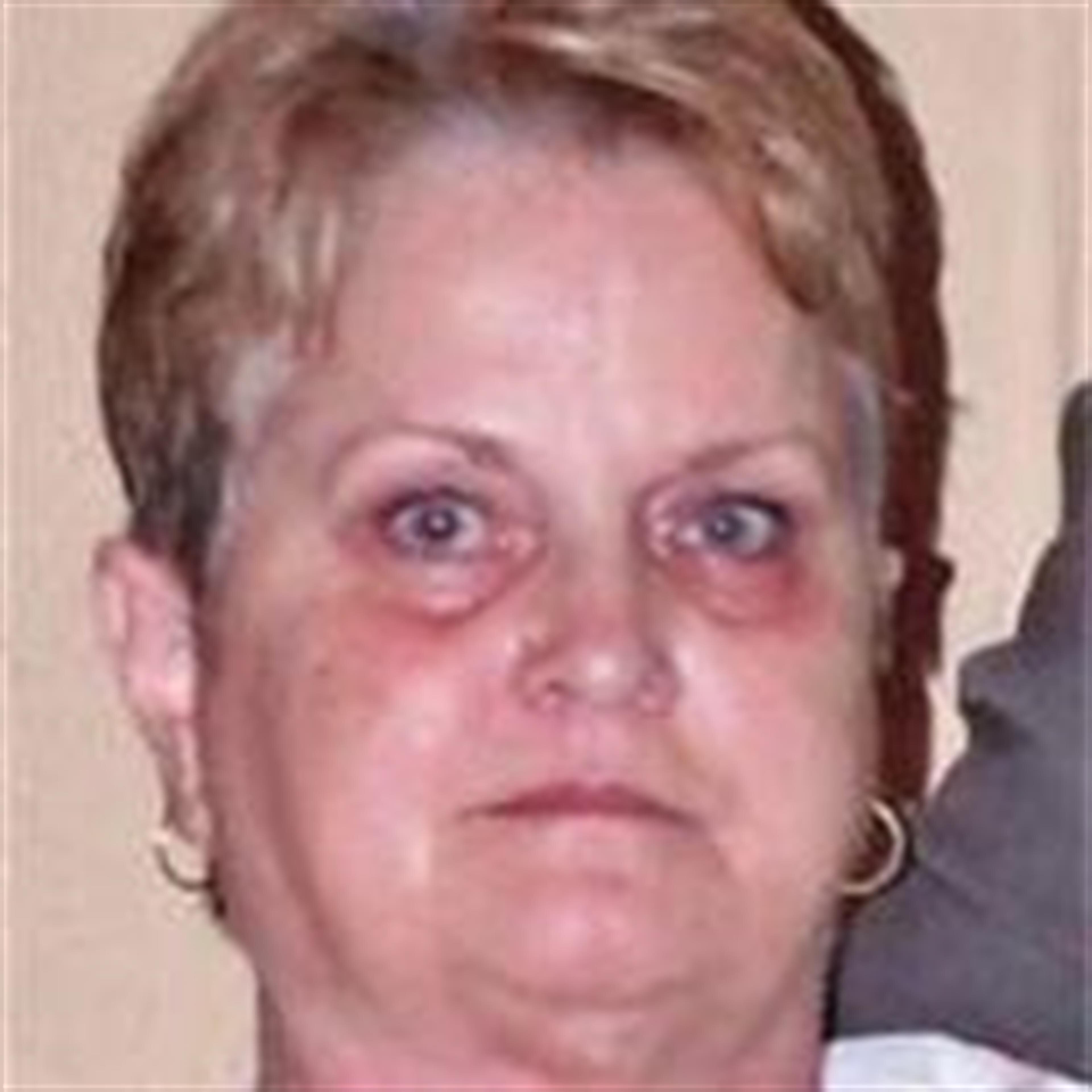 Darlene Limberger