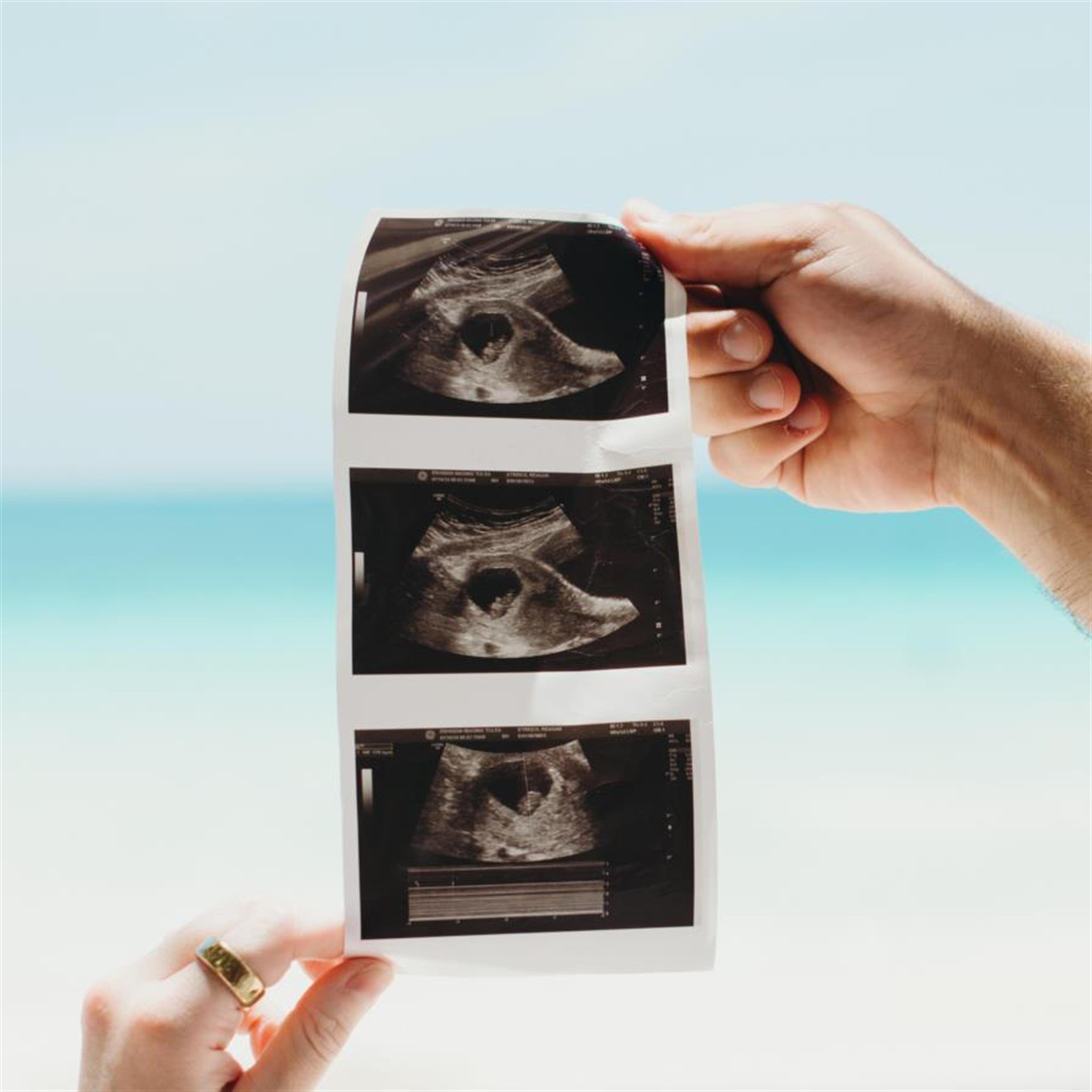 Baby Sofia Wren Streich