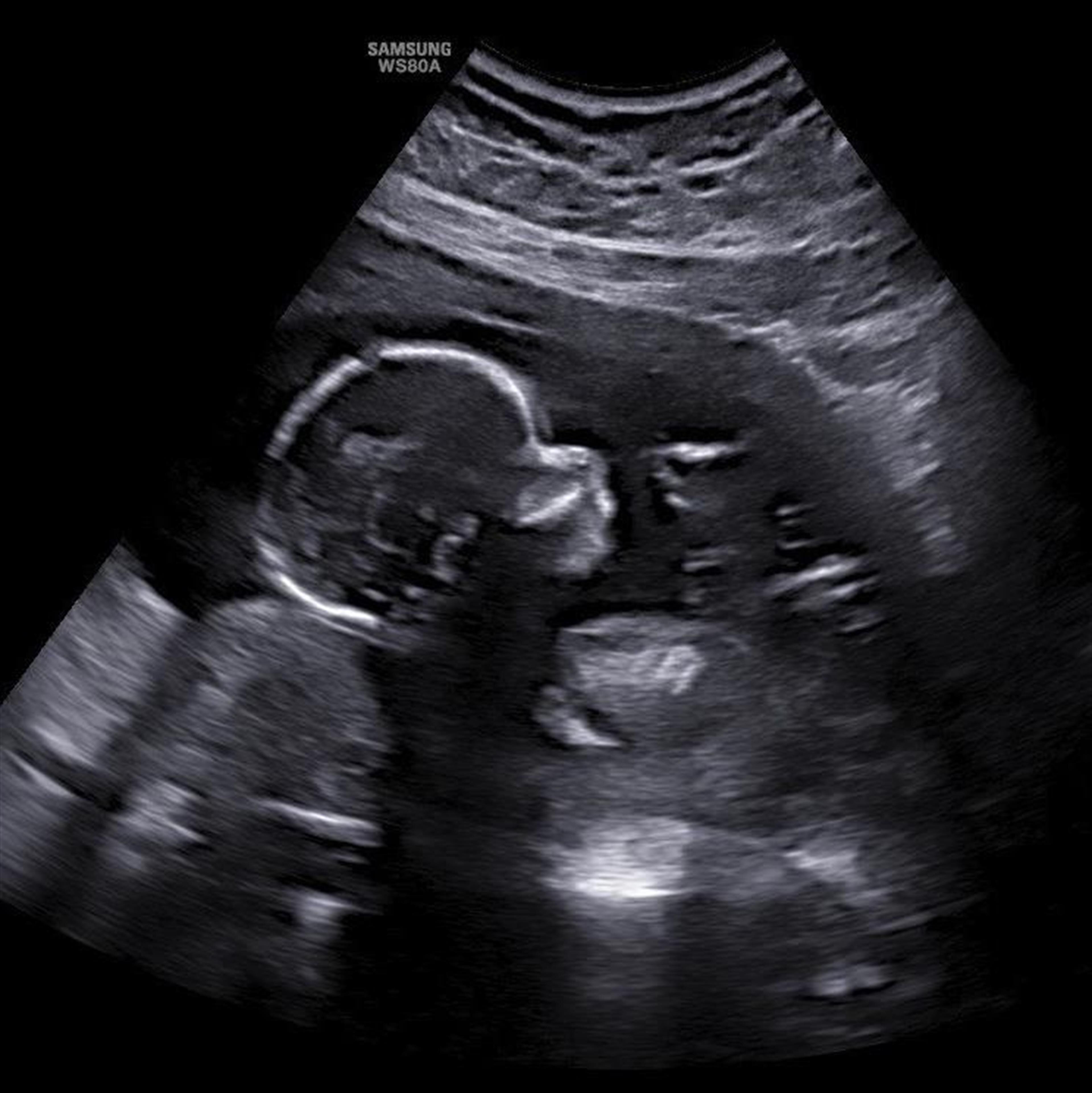 Jru Madisyn Ann Green