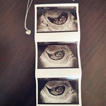 Baby Cora Lippmann