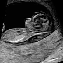 Evangeline Waizenegger