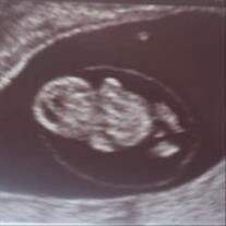 A'rmani Rose Roque