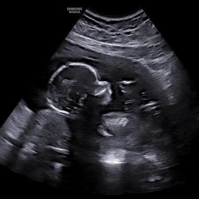 Jru Madisyn Ann Green