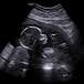 Jru Madisyn Ann Green